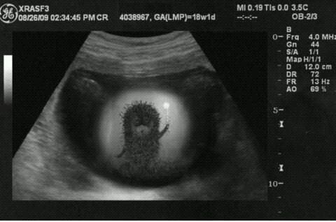 Аватар, аватар, аватар.... - 62KDfZ62ETE.jpg
